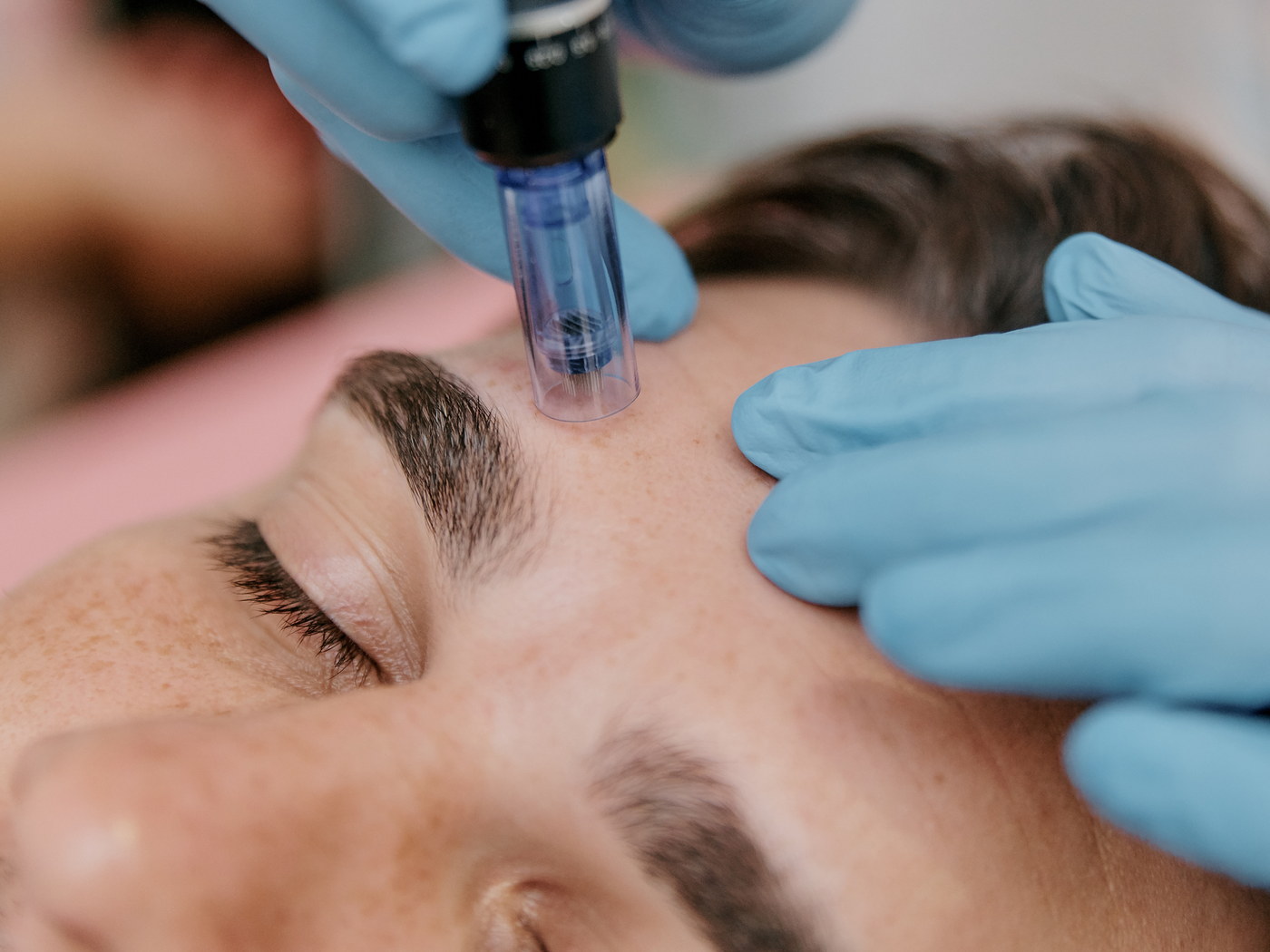 Dermapen