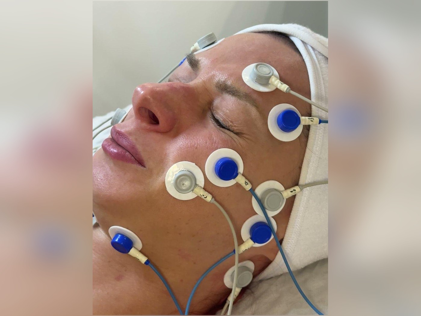 Elektrodi izvietoti pa sejas muskuļu līnijām