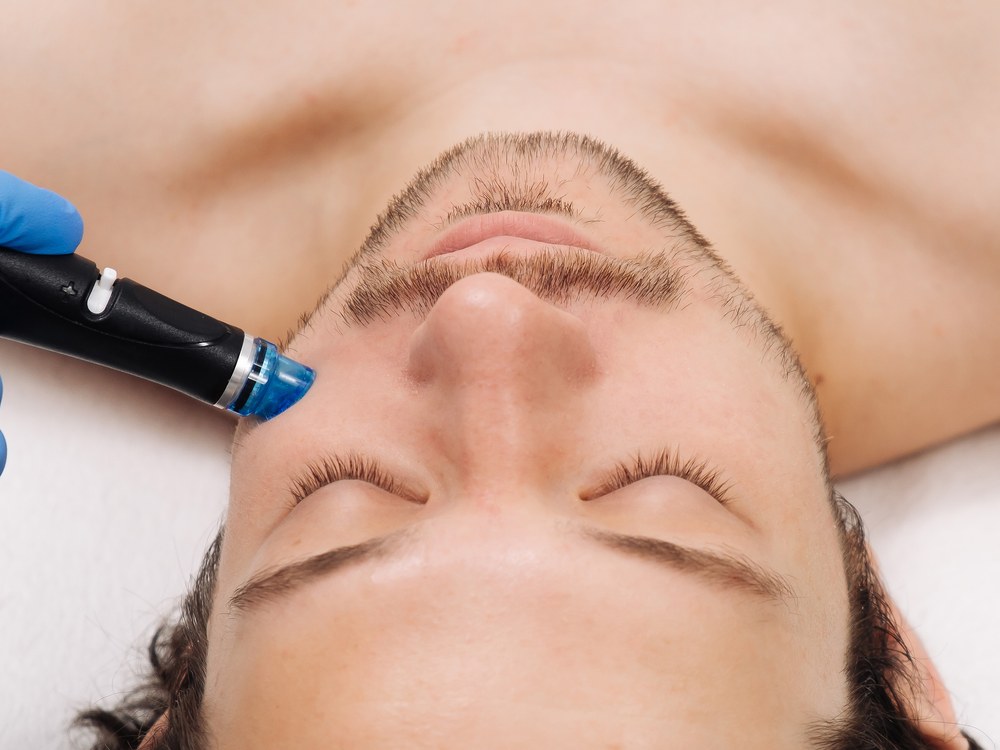 HydraFacial® vīriešiem
