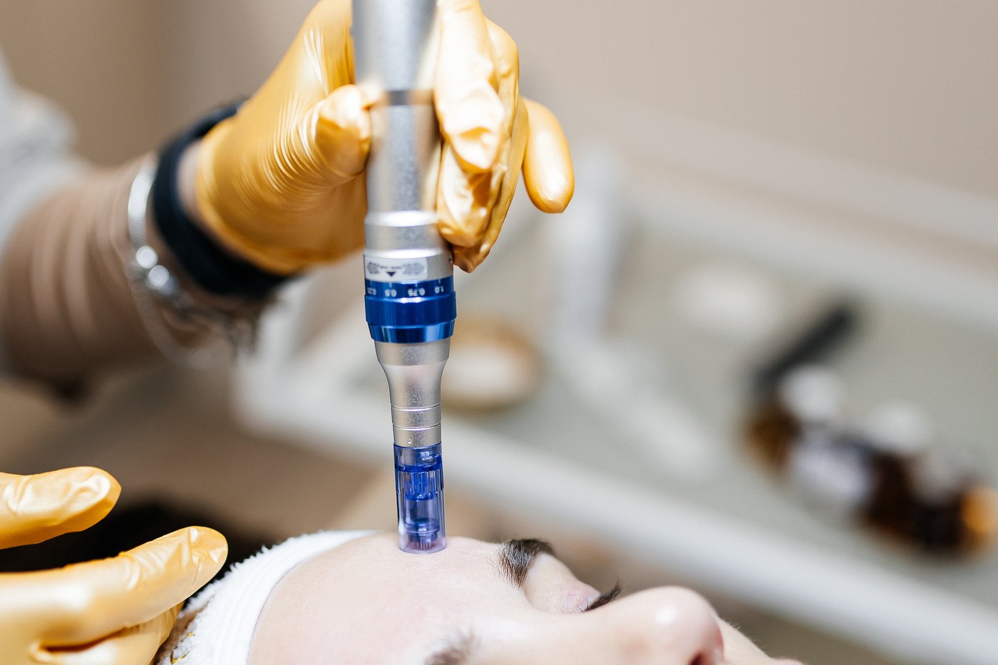 Mikroadatu terapija ar Dr.pen Beauty Innovations salonā
