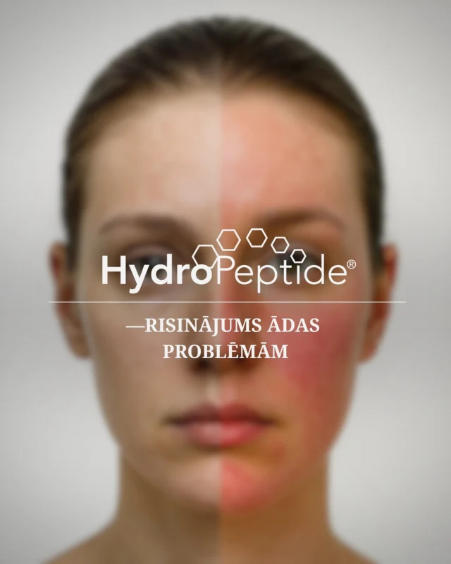 Rodas ādas problēmas? Mēs zinām risinājumu!✨Mūsu must-have līdzekļu izlase no zīmola HydroPeptide:▫️Sausa āda un tonusa zudums? → Power Lift – intensīva mitrināšana + liftinga efekts▫️Kuperoze un apsārtums? → Soothing Serum – tūlītēja nomierināšana un asinsvadu stiprināšana▫️Pigmentācija un blāvs tonis? → LumaPro-C – intensīva izgaismošana un ādas mirdzums▫️Aknē un taukains spīdums? → Clear Rescue – samazina iekaisuma elementus un atjauno mikrobiomu▫️Grumbas un samazināta ādas blīvuma sajūta? → Nimni Cream – dāvā ādai otro jaunībuHydroPeptide – peptīdu spēks, Jūsu ādas skaistums!🤍📍 Lāčplēša iela 24📞 +371 25 590 890#salonsriga #skaistumkopšana #салонрига #beautyinnovations #kosmetoloģija #hydropeptide